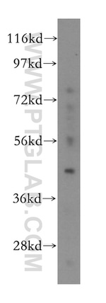 ACADL Antibody in Western Blot (WB)