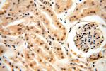 HDAC4 Antibody in Immunohistochemistry (Paraffin) (IHC (P))