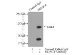 HDAC4 Antibody in Immunoprecipitation (IP)