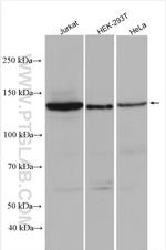 HDAC4 Antibody in Western Blot (WB)