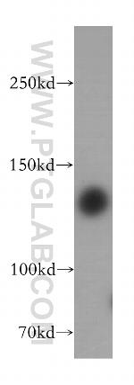 HDAC4 Antibody in Western Blot (WB)