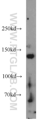 HDAC4 Antibody in Western Blot (WB)