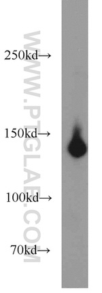 HDAC4 Antibody in Western Blot (WB)