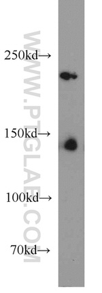 HDAC4 Antibody in Western Blot (WB)