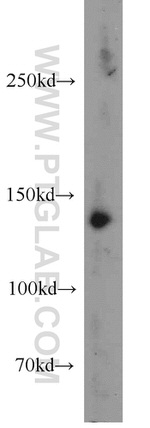 HDAC4 Antibody in Western Blot (WB)