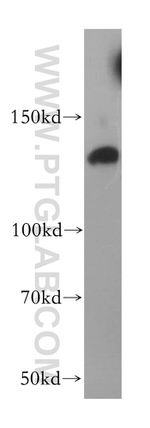 HDAC4 Antibody in Western Blot (WB)