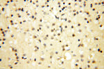 COQ5 Antibody in Immunohistochemistry (Paraffin) (IHC (P))