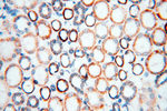 COQ5 Antibody in Immunohistochemistry (Paraffin) (IHC (P))