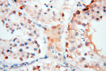 COQ5 Antibody in Immunohistochemistry (Paraffin) (IHC (P))