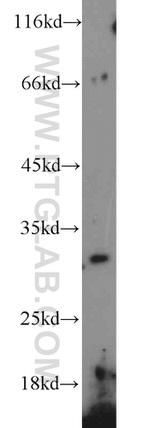 COQ5 Antibody in Western Blot (WB)