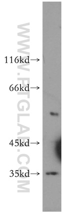 COQ5 Antibody in Western Blot (WB)