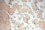 RTKN2 Antibody in Immunohistochemistry (Paraffin) (IHC (P))