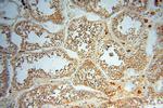 RTKN2 Antibody in Immunohistochemistry (Paraffin) (IHC (P))