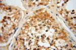 RTKN2 Antibody in Immunohistochemistry (Paraffin) (IHC (P))