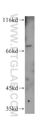 RTKN2 Antibody in Western Blot (WB)