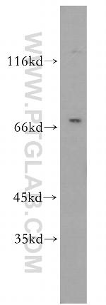 RTKN2 Antibody in Western Blot (WB)