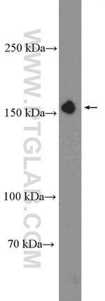 IFT140 Antibody in Western Blot (WB)