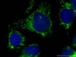 FASTKD2 Antibody in Immunocytochemistry (ICC/IF)