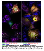 FASTKD2 Antibody in Immunocytochemistry (ICC/IF)