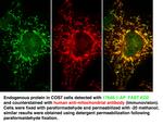 FASTKD2 Antibody in Immunocytochemistry (ICC/IF)