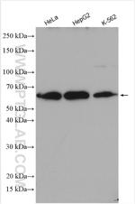 FASTKD2 Antibody in Western Blot (WB)