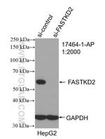 FASTKD2 Antibody in Western Blot (WB)