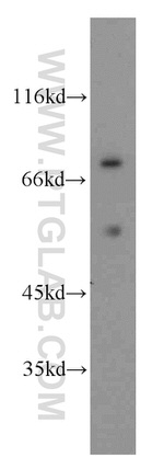 FASTKD2 Antibody in Western Blot (WB)