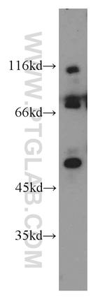 FASTKD2 Antibody in Western Blot (WB)