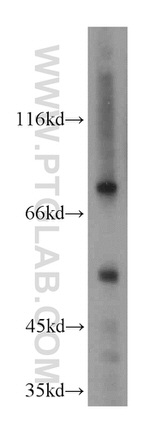 FASTKD2 Antibody in Western Blot (WB)