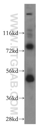 FASTKD2 Antibody in Western Blot (WB)