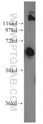 LCORL Antibody in Western Blot (WB)