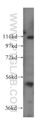 CLUAP1 Antibody in Western Blot (WB)