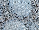 CCR5 Antibody in Immunohistochemistry (Paraffin) (IHC (P))