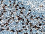 CCR5 Antibody in Immunohistochemistry (Paraffin) (IHC (P))