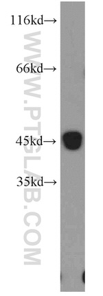 CCR5 Antibody in Western Blot (WB)