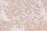 ANUBL1 Antibody in Immunohistochemistry (Paraffin) (IHC (P))