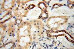 YTHDF1 Antibody in Immunohistochemistry (Paraffin) (IHC (P))