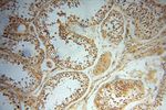 YTHDF1 Antibody in Immunohistochemistry (Paraffin) (IHC (P))