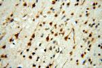 YTHDF1 Antibody in Immunohistochemistry (Paraffin) (IHC (P))