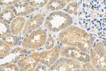 YTHDF1 Antibody in Immunohistochemistry (Paraffin) (IHC (P))