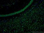 YTHDF1 Antibody in Immunohistochemistry (PFA fixed) (IHC (PFA))