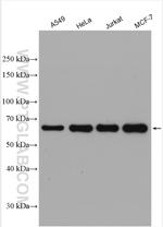 YTHDF1 Antibody in Western Blot (WB)