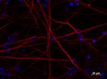 MAP2 Antibody in Immunocytochemistry (ICC/IF)