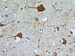 MAP2 Antibody in Immunohistochemistry (Paraffin) (IHC (P))