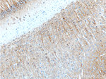 MAP2 Antibody in Immunohistochemistry (Paraffin) (IHC (P))