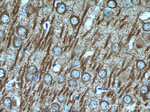 MAP2 Antibody in Immunohistochemistry (Paraffin) (IHC (P))