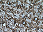 MAP2 Antibody in Immunohistochemistry (Paraffin) (IHC (P))