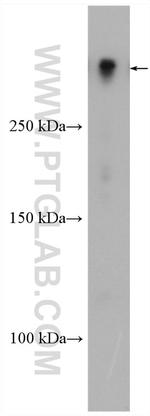 MAP2 Antibody in Western Blot (WB)