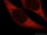 MYO1A Antibody in Immunocytochemistry (ICC/IF)