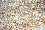 MYO1A Antibody in Immunohistochemistry (Paraffin) (IHC (P))